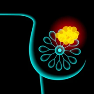 Antibody Therapy Against Neoantigens